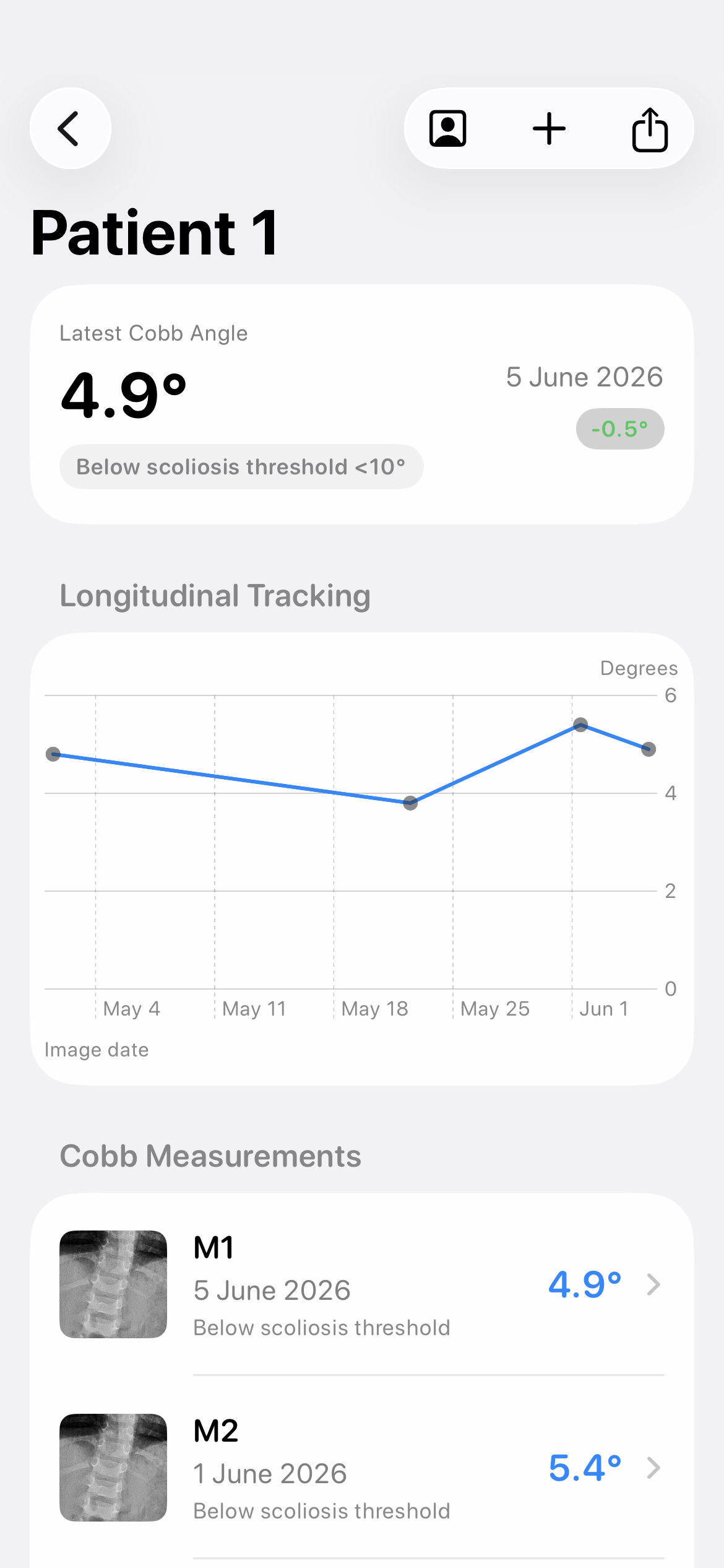Cobb Angle Pro light mode patient progress tracking