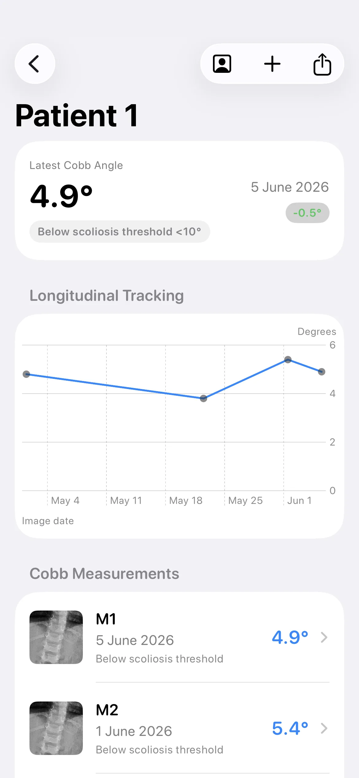 Cobb Angle Pro light mode patient progress tracking